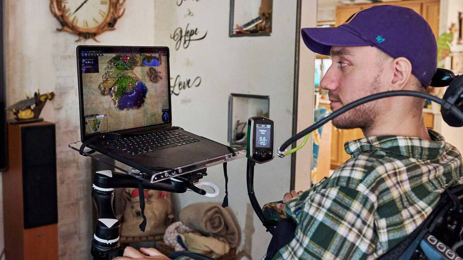 Noland Arbaugh - telekinetic